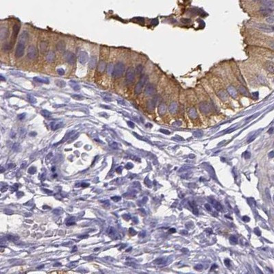 PAH Antibody in Immunohistochemistry (IHC)