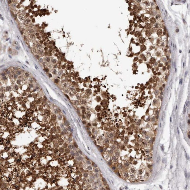 MED8 Antibody in Immunohistochemistry (IHC)