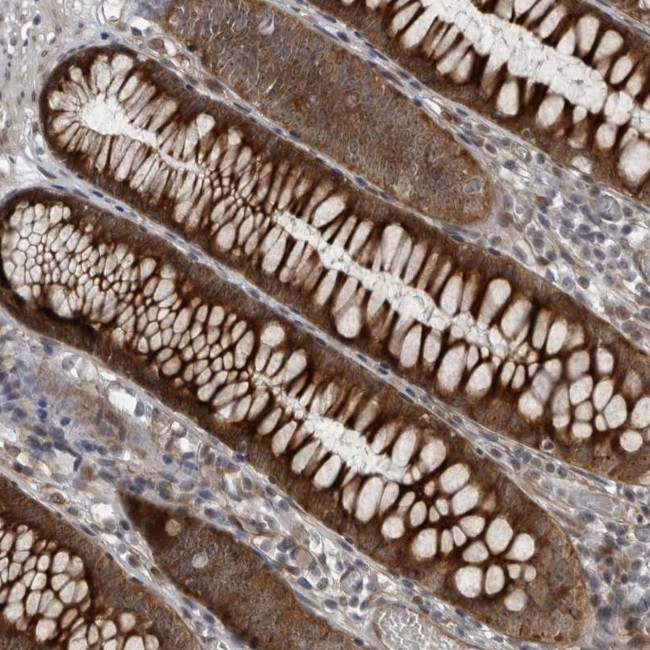 F102B Antibody in Immunohistochemistry (Paraffin) (IHC (P))