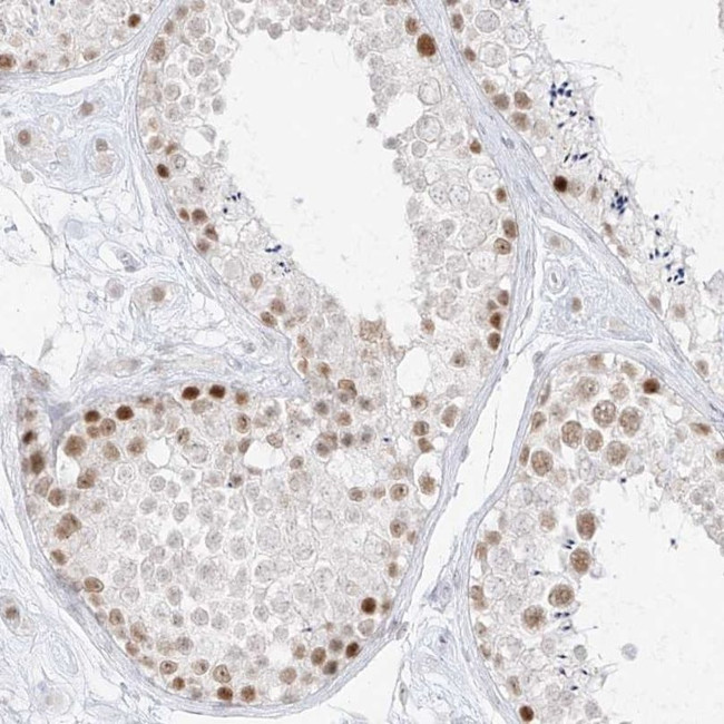 SPT5 Antibody in Immunohistochemistry (IHC)