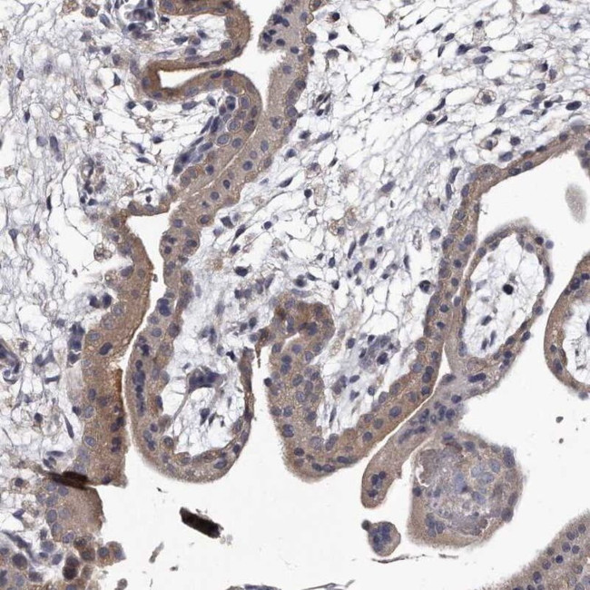 GAPVD1 Antibody in Immunohistochemistry (IHC)