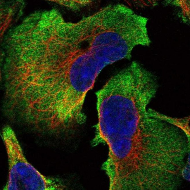 SPATC1L Antibody in Immunocytochemistry (ICC/IF)