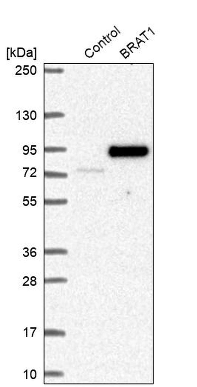 BAAT1 Antibody in Western Blot (WB)