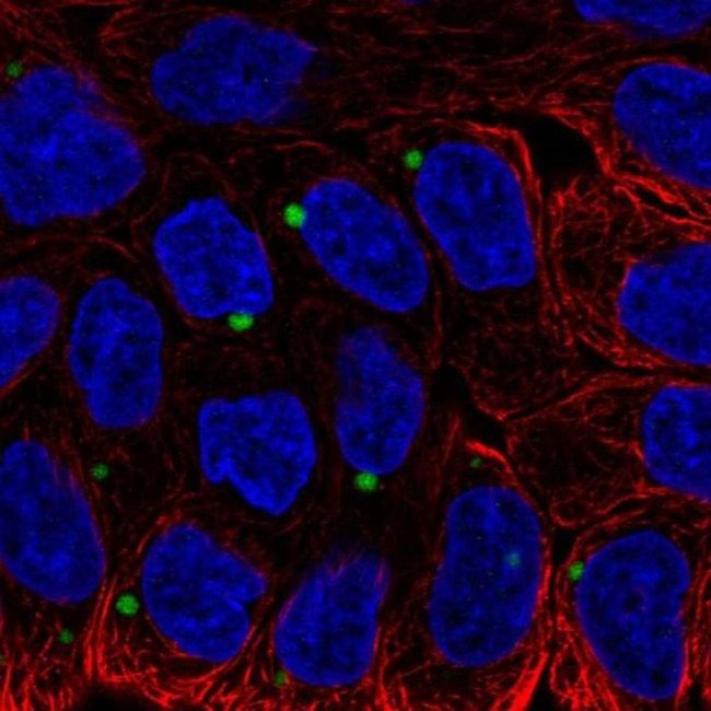 EDEM1 Antibody in Immunocytochemistry (ICC/IF)