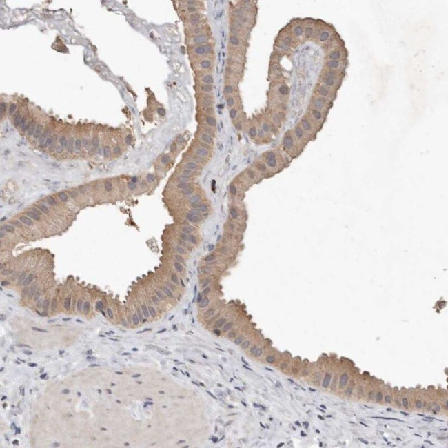 EDEM1 Antibody in Immunohistochemistry (IHC)