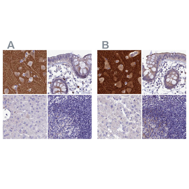 SNAP91 Antibody in Immunohistochemistry (IHC)