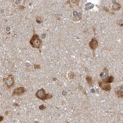 DARS Antibody in Immunohistochemistry (IHC)