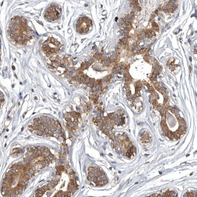 DARS Antibody in Immunohistochemistry (IHC)