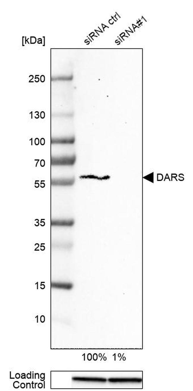 DARS Antibody in Western Blot (WB)