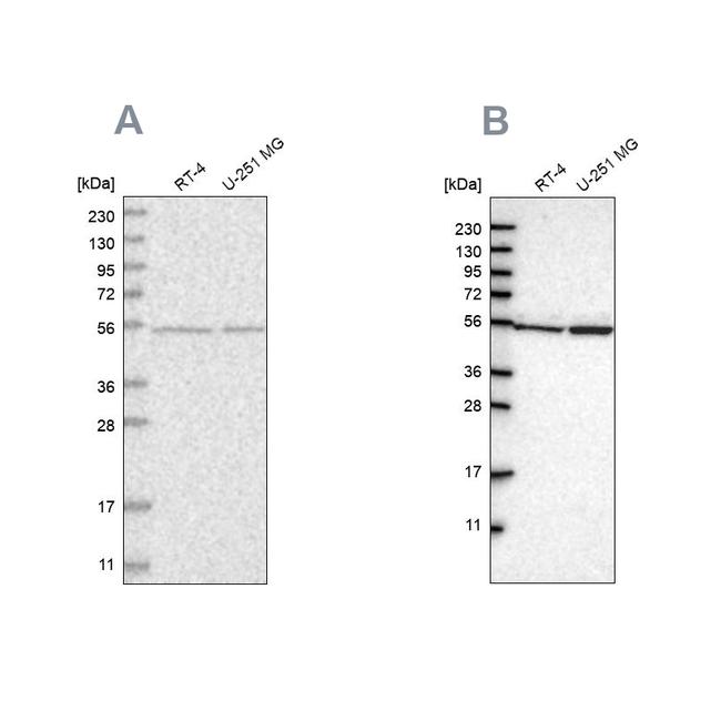 DARS Antibody in Western Blot (WB)