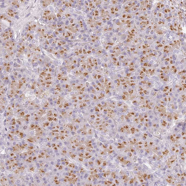 KIAA1324 Antibody in Immunohistochemistry (IHC)