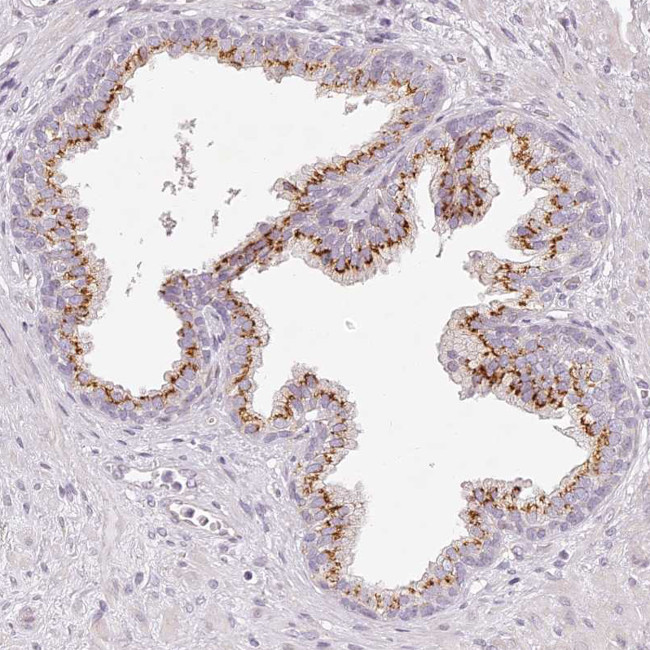 KIAA1324 Antibody in Immunohistochemistry (IHC)