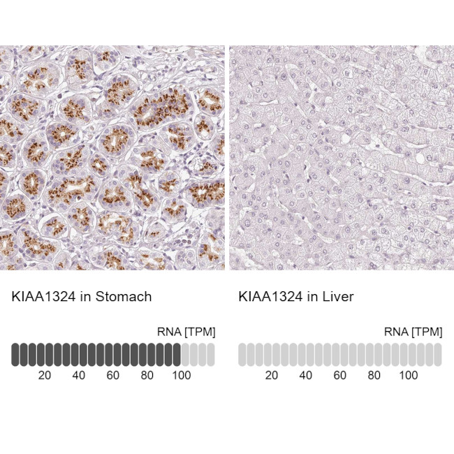 KIAA1324 Antibody