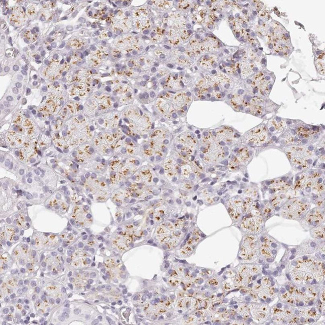 KIAA1324 Antibody in Immunohistochemistry (IHC)