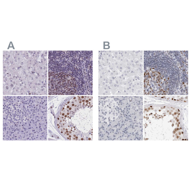 NASP Antibody in Immunohistochemistry (IHC)