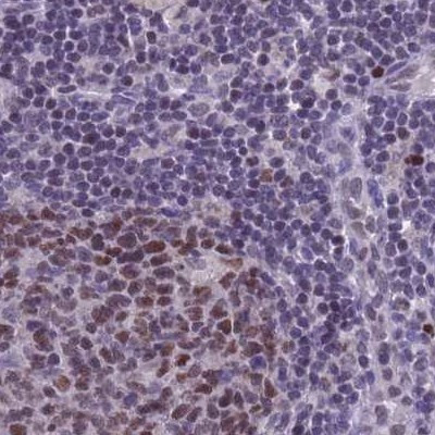 NASP Antibody in Immunohistochemistry (IHC)