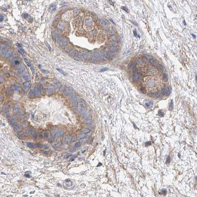 UFL1 Antibody in Immunohistochemistry (IHC)