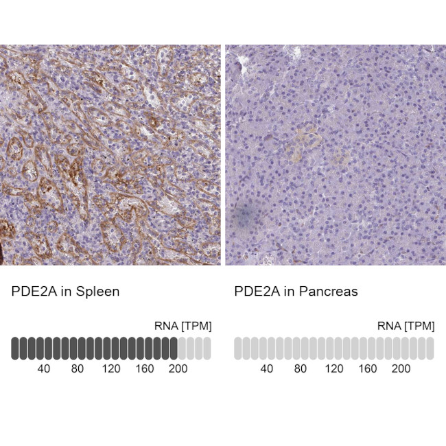 PDE2A Antibody in Immunohistochemistry (IHC)