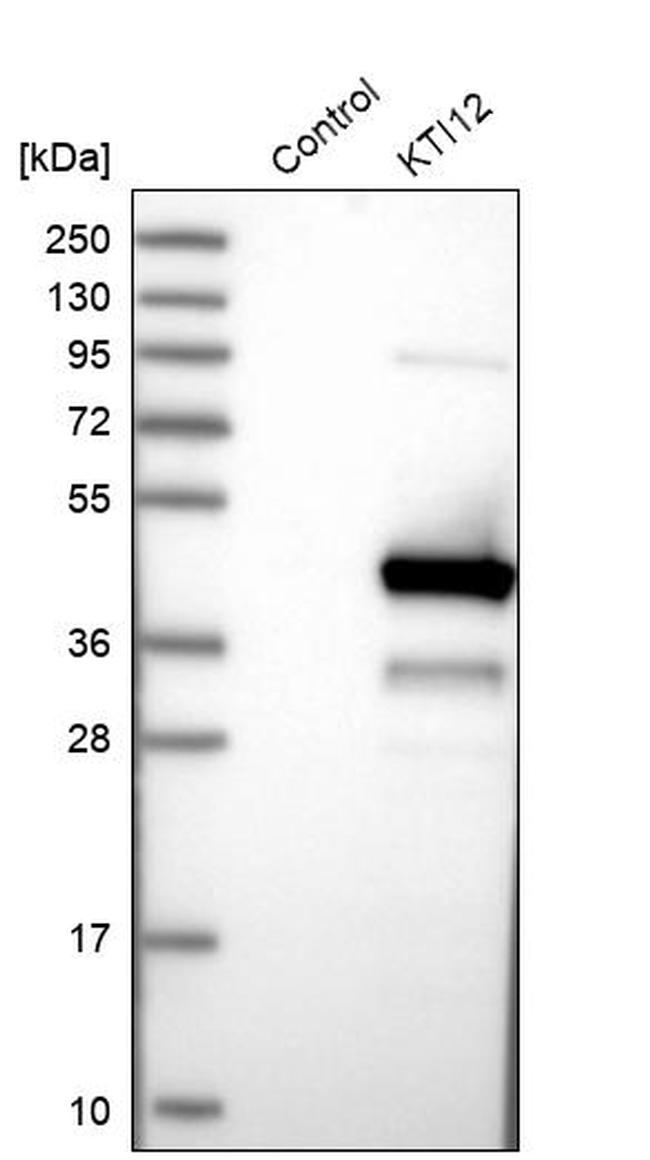 KTI12 Antibody in Western Blot (WB)