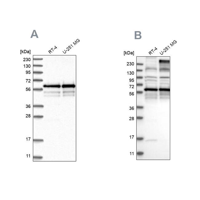 BSDC1 Antibody in Western Blot (WB)