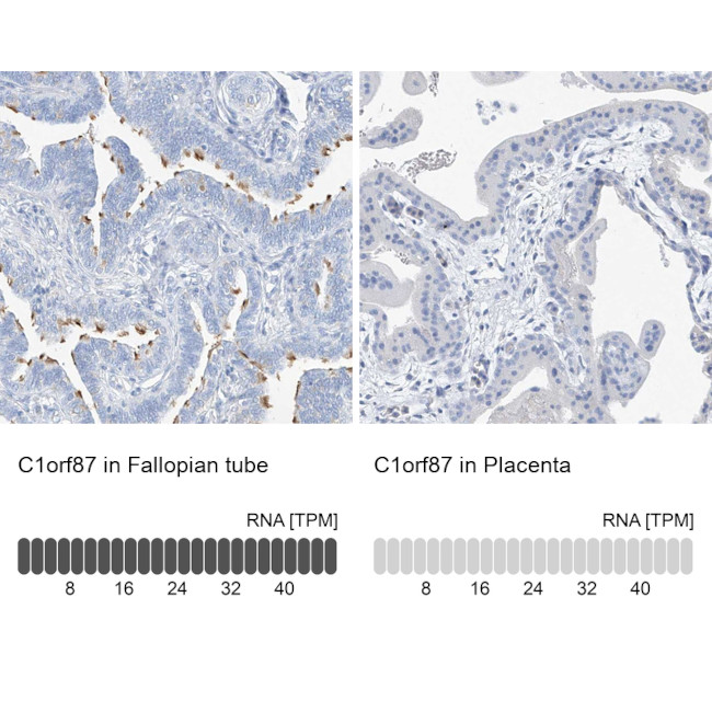 C1orf87 Antibody in Immunohistochemistry (IHC)