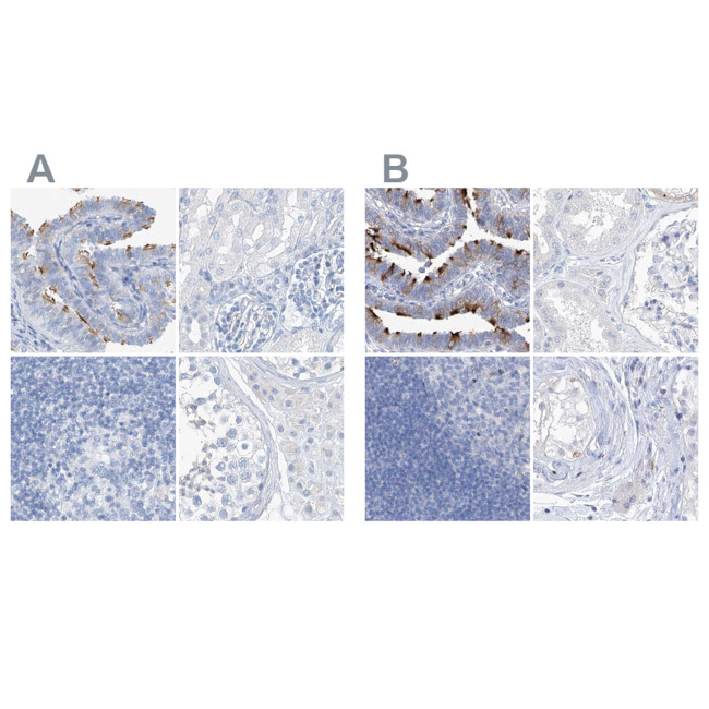 C1orf87 Antibody in Immunohistochemistry (IHC)