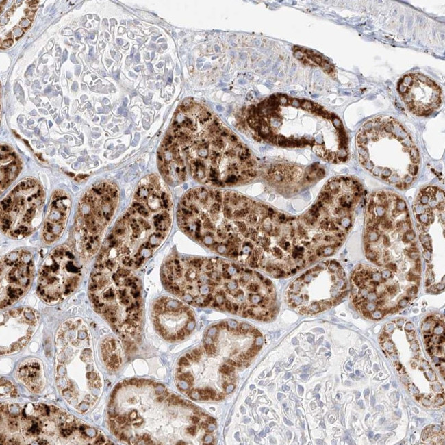 MTX2 Antibody in Immunohistochemistry (Paraffin) (IHC (P))