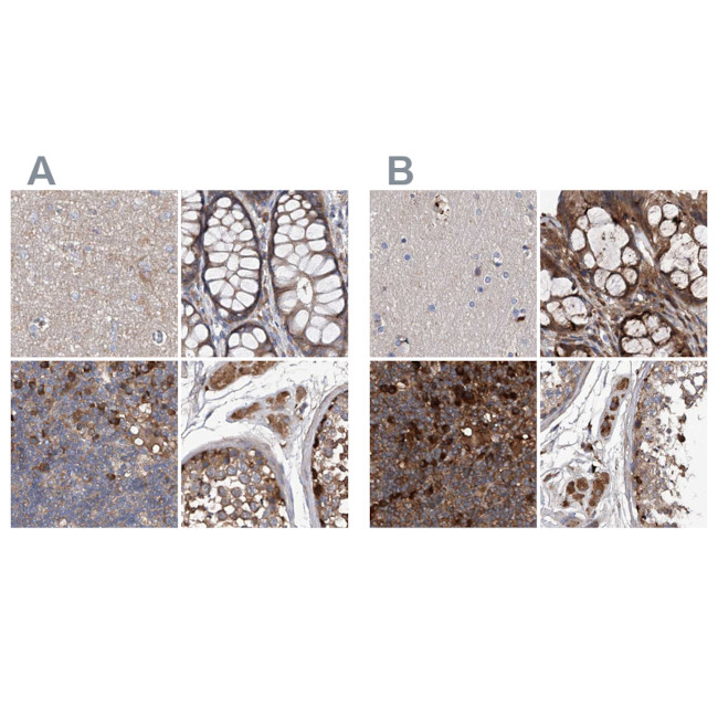 ASCC3 Antibody in Immunohistochemistry (IHC)