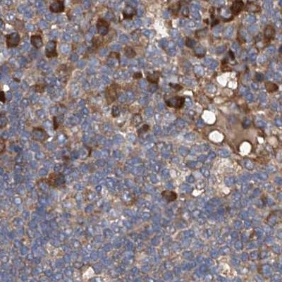 ASCC3 Antibody in Immunohistochemistry (IHC)