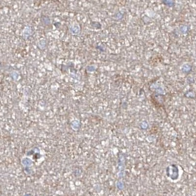 ASCC3 Antibody in Immunohistochemistry (IHC)