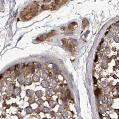 ASCC3 Antibody in Immunohistochemistry (IHC)