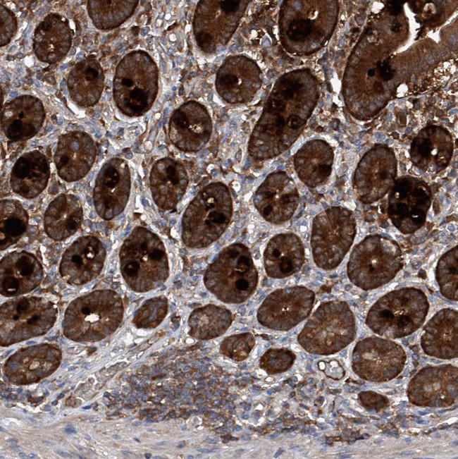 ASCC3 Antibody in Immunohistochemistry (IHC)