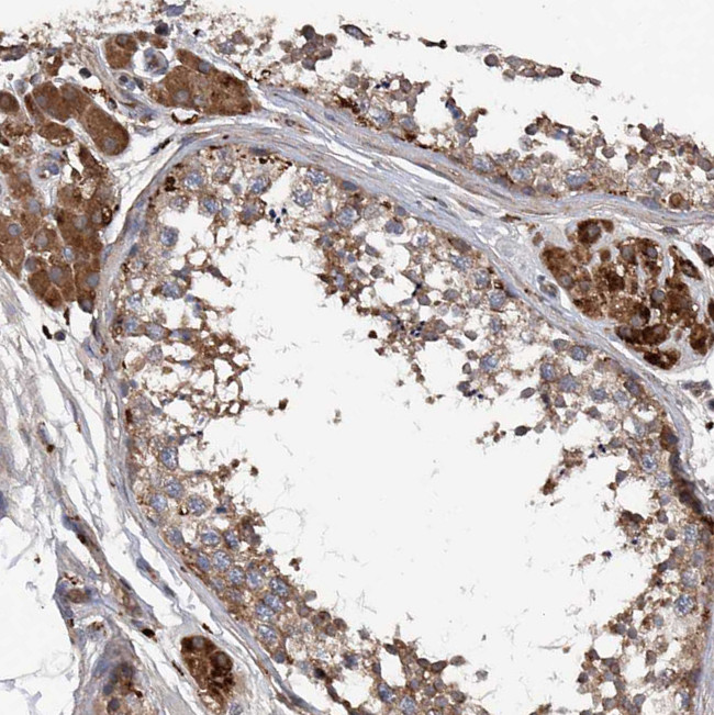 ASCC3 Antibody in Immunohistochemistry (IHC)