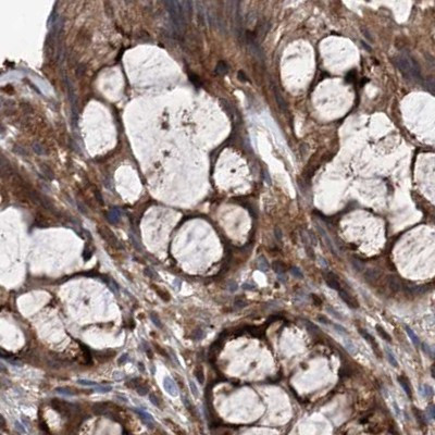 ASCC3 Antibody in Immunohistochemistry (IHC)