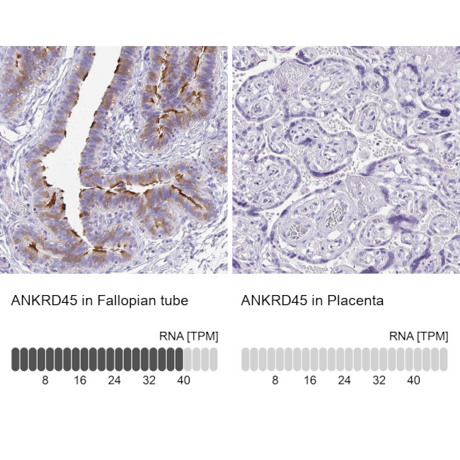 ANKRD45 Antibody in Immunohistochemistry (IHC)