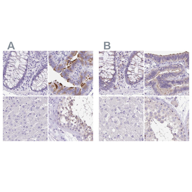 ANKRD45 Antibody in Immunohistochemistry (IHC)