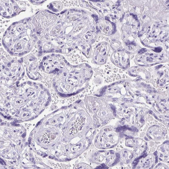 ANKRD45 Antibody in Immunohistochemistry (IHC)