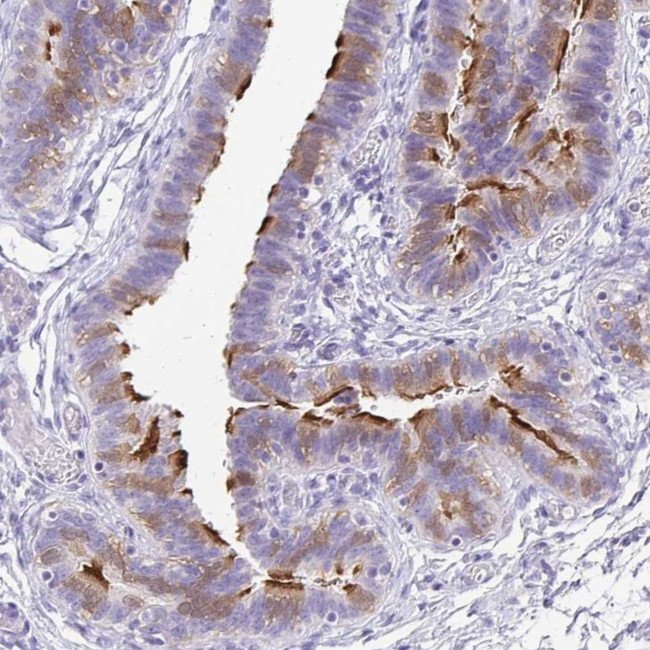 ANKRD45 Antibody in Immunohistochemistry (IHC)