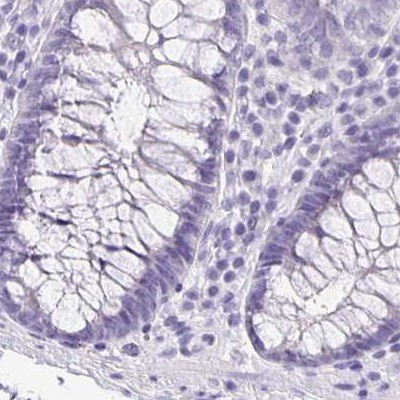 ANKRD45 Antibody in Immunohistochemistry (IHC)