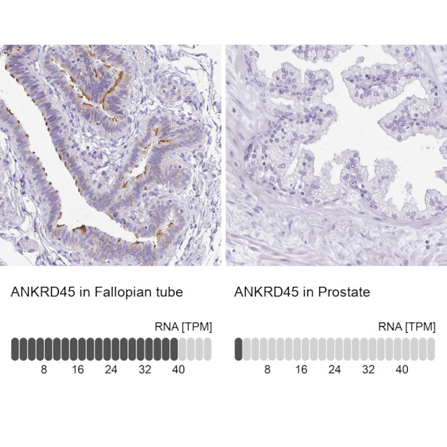 ANKRD45 Antibody in Immunohistochemistry (IHC)