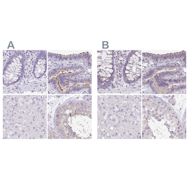 ANKRD45 Antibody in Immunohistochemistry (IHC)