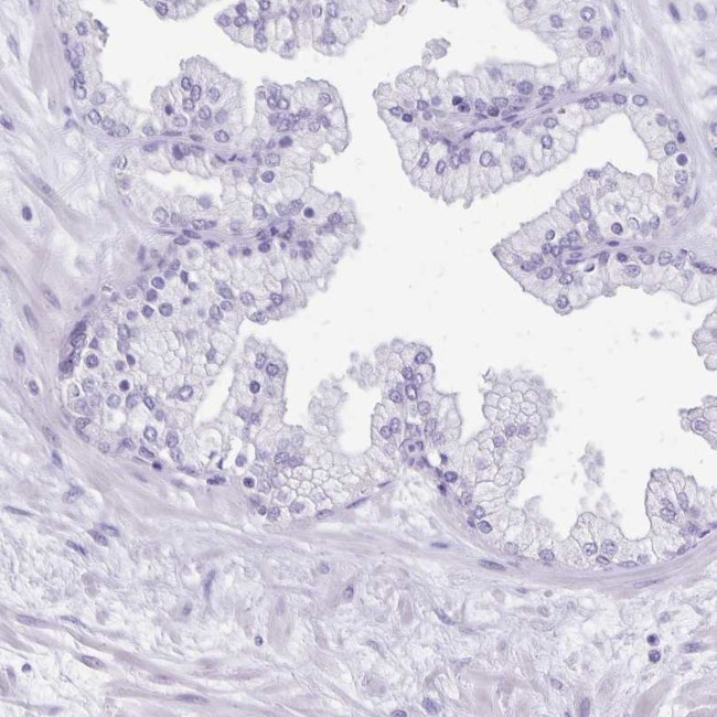 ANKRD45 Antibody in Immunohistochemistry (IHC)