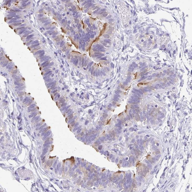 ANKRD45 Antibody in Immunohistochemistry (IHC)