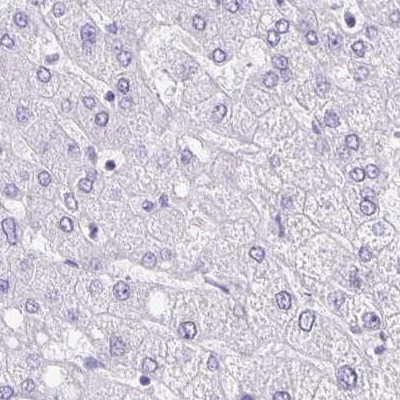 ANKRD45 Antibody in Immunohistochemistry (IHC)