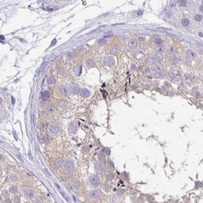 ANKRD45 Antibody in Immunohistochemistry (IHC)