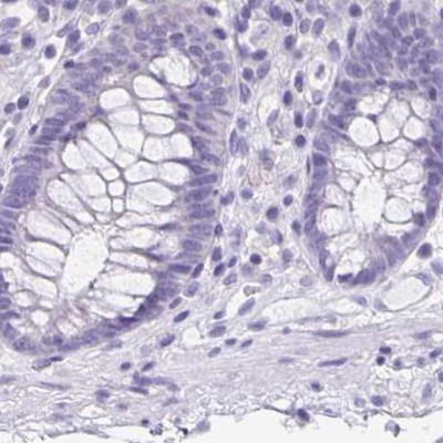 ANKRD45 Antibody in Immunohistochemistry (IHC)