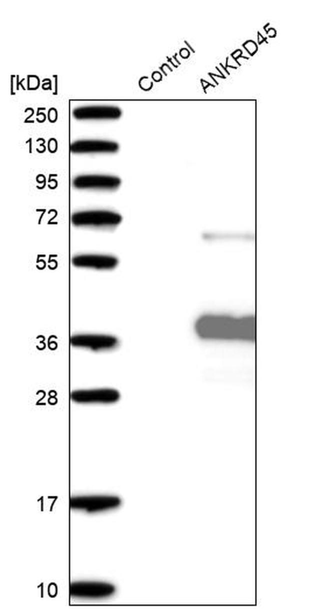 ANKRD45 Antibody in Western Blot (WB)