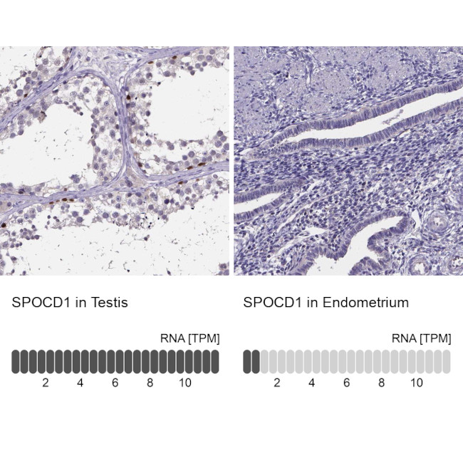 SPOCD1 Antibody in Immunohistochemistry (IHC)