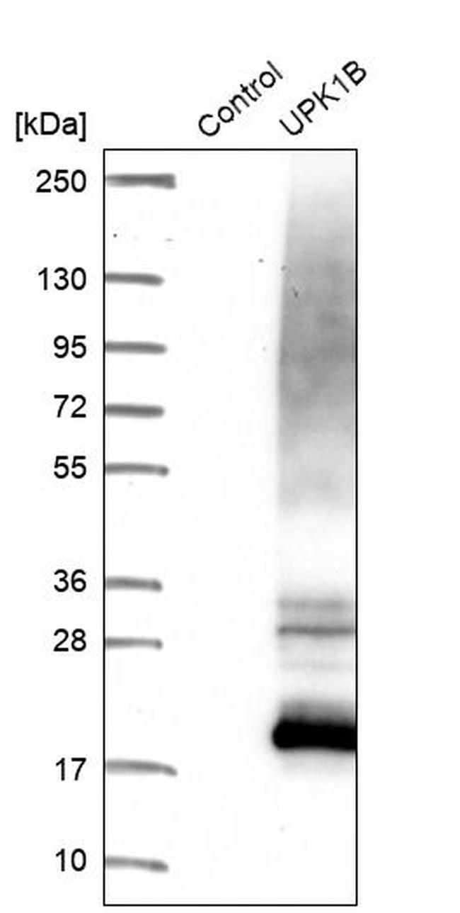 UPK1B Antibody in Western Blot (WB)