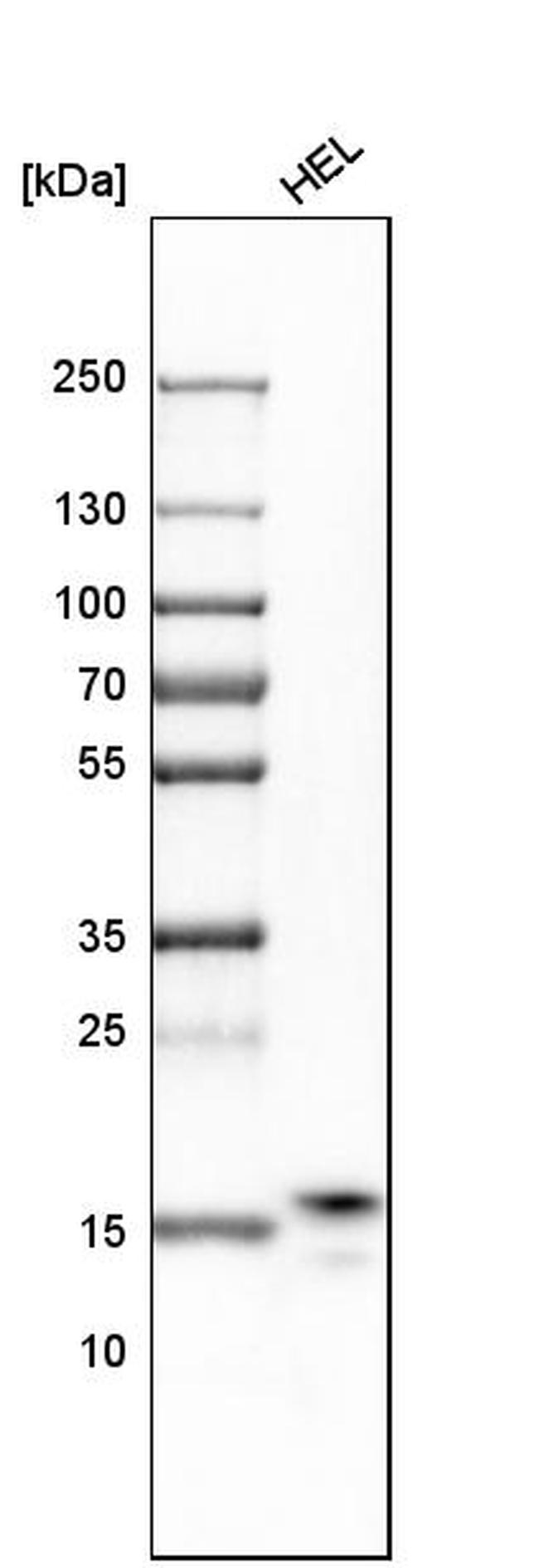 RPS25 Antibody in Western Blot (WB)